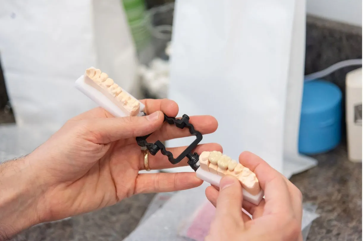 A dentist holding a tooth-colored restoration on a model