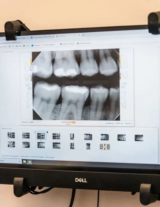 Digital x-rays on the screen in a Dental Korner treatment room